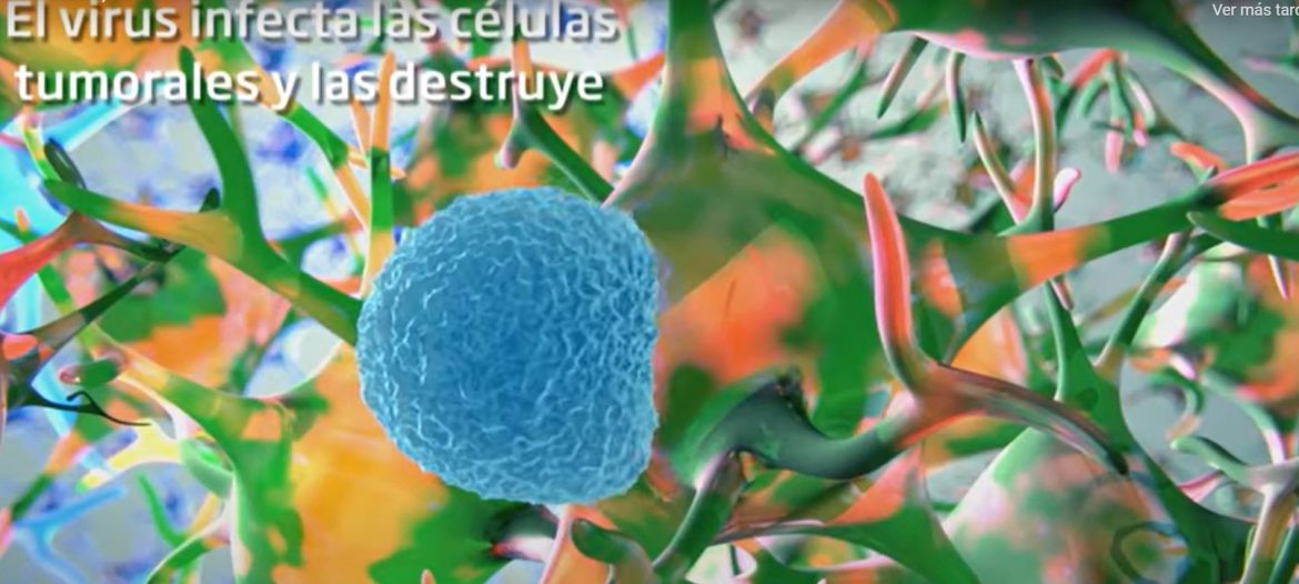 Glioma, tratamiento
