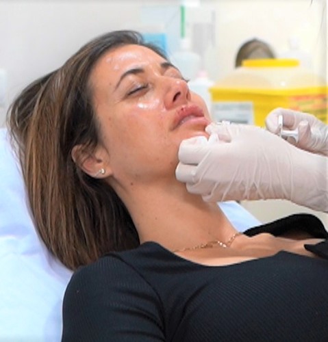 Belleza facial: labios, con ácido hialurónico.
