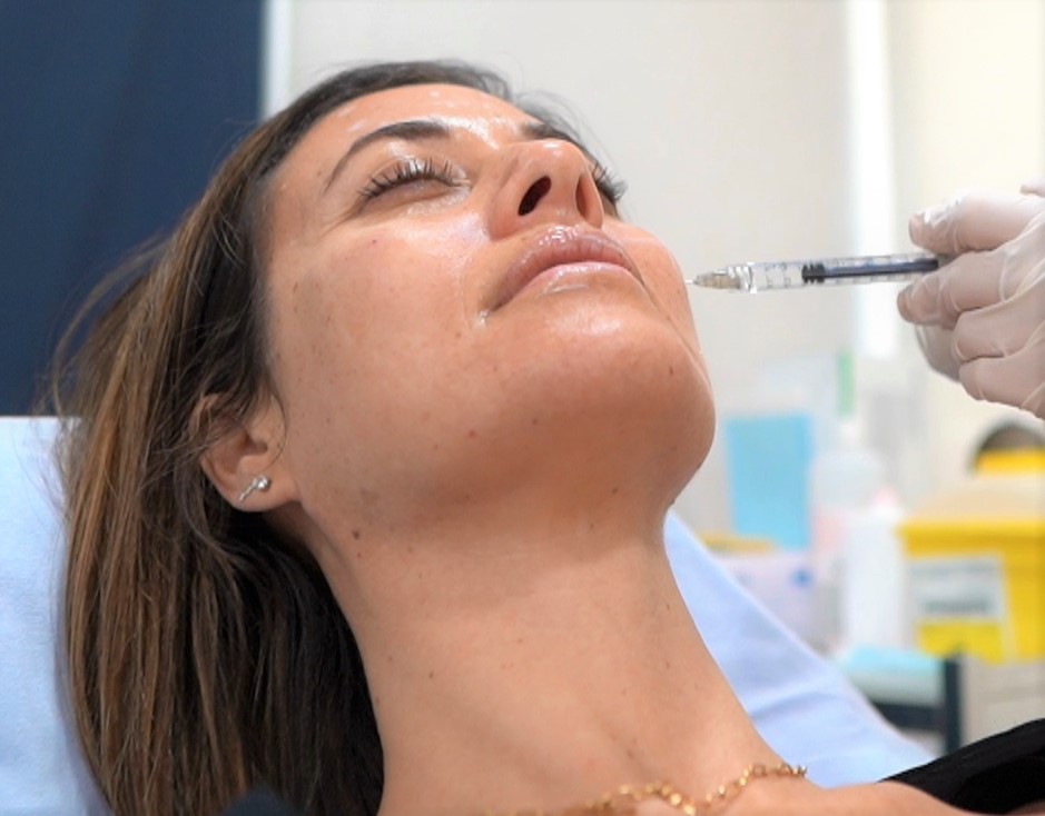 Belleza facial: pómulo, con ácido hialurónico.