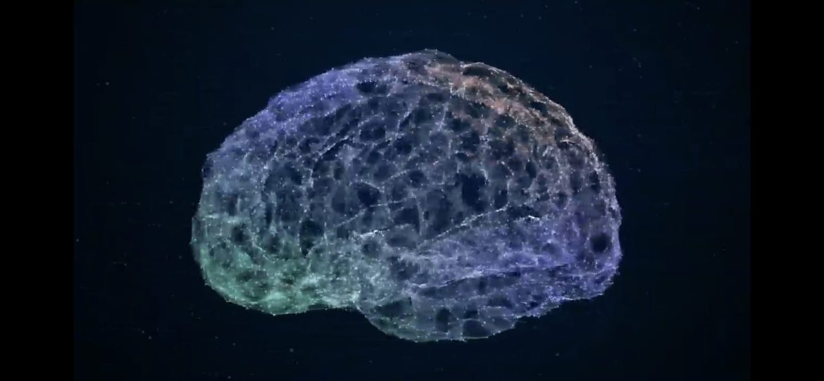 tumor cerebral proyecto NEMESISesis
