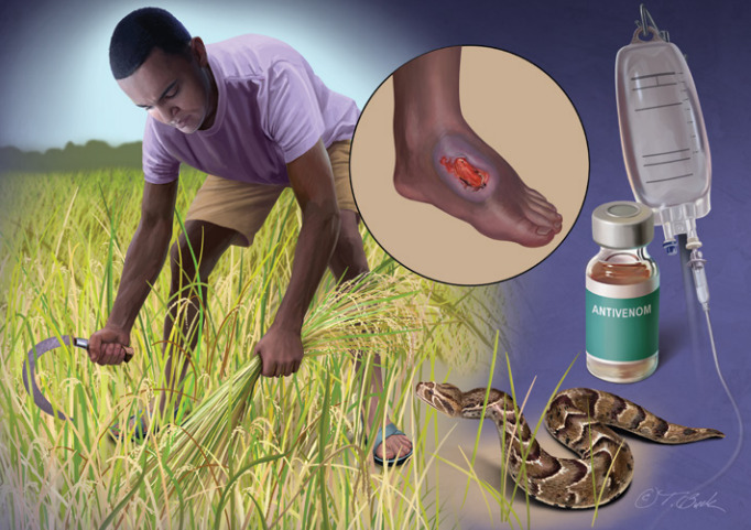 Enfermedades tropicales desatendidas MSF