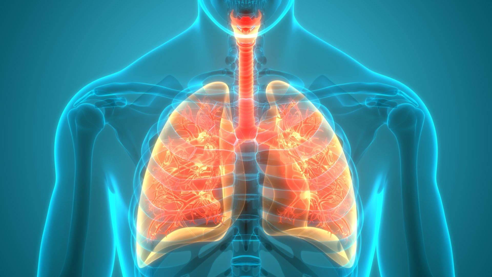 enfisema pulmonar