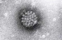 Cáncer en la garganta por papilomavirus VPH