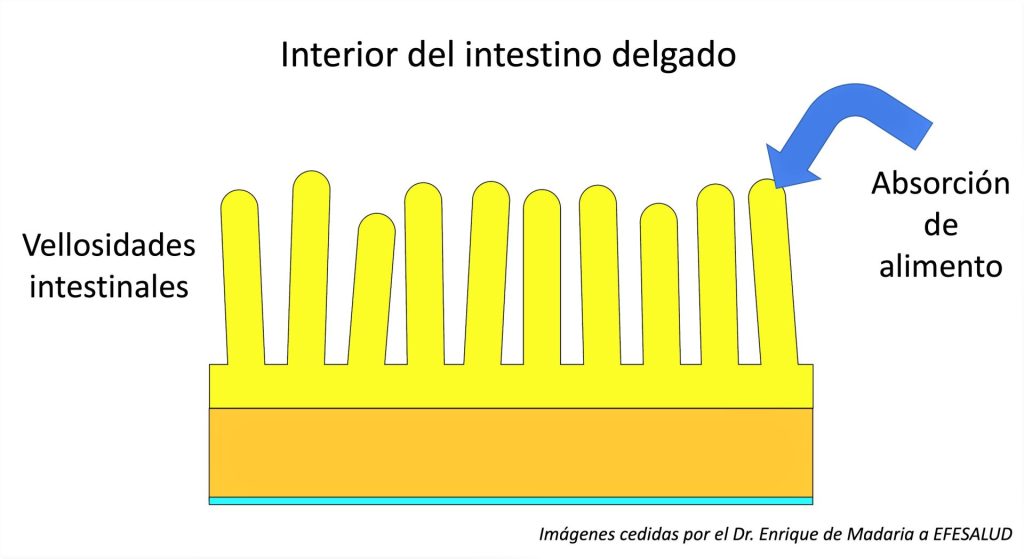 Los efectos del gluten en el aparato digestivo.