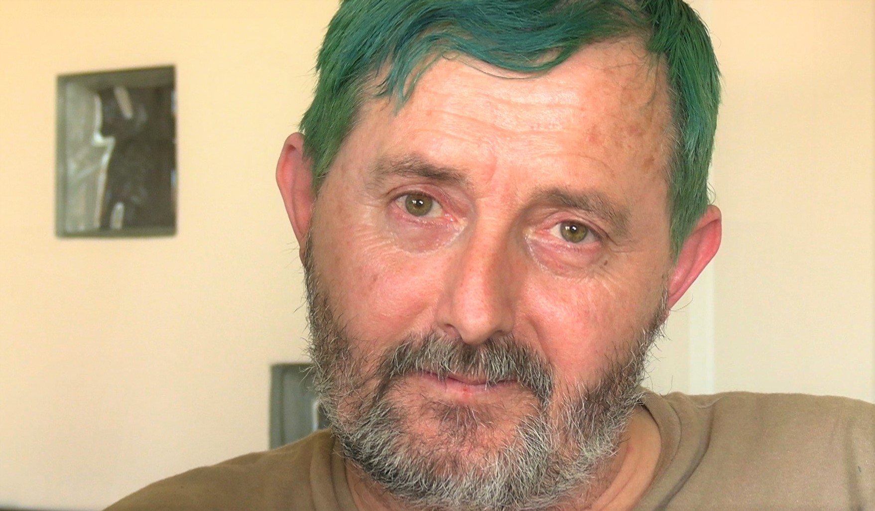 Esclerosis Lateral Amiotrófica (ELA).