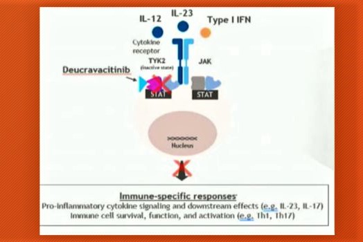 Actualización tratamientos psoriasis.