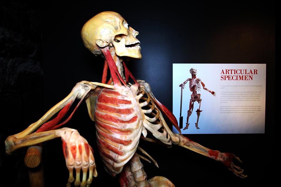 Articulaciones artrosis