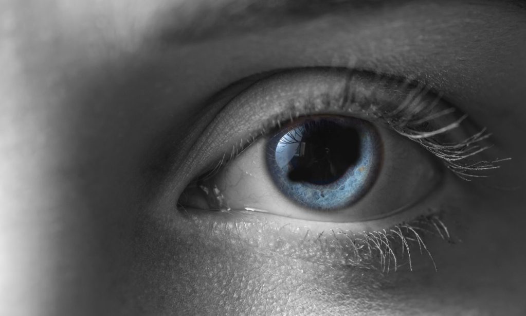 Ojo con aniridia