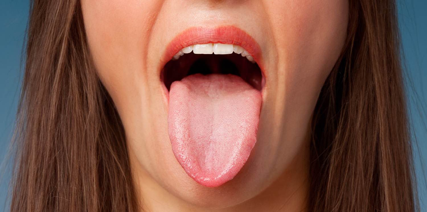 lengua enfermedades