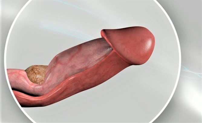 10 curiosidades del pene