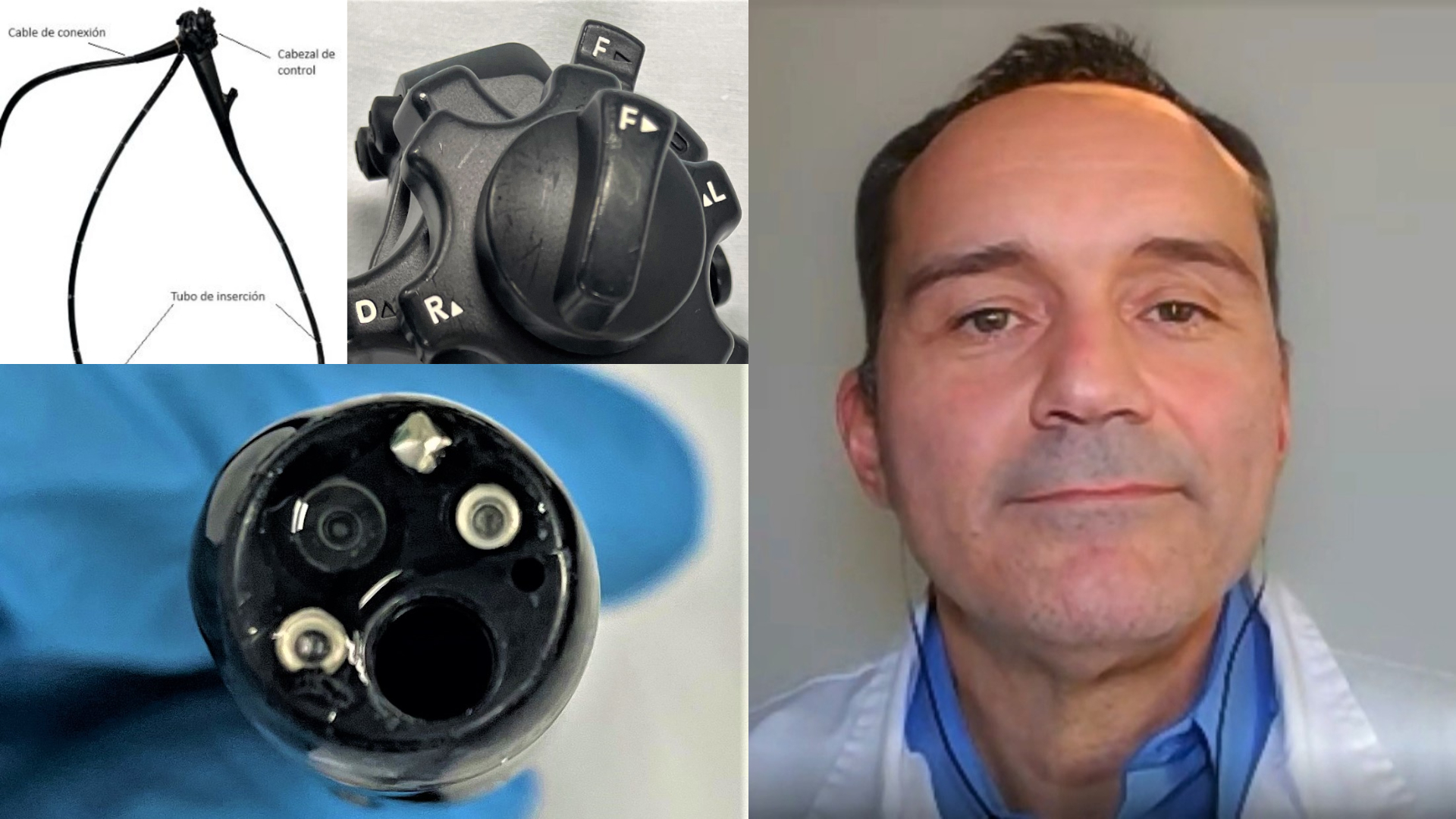 Endoscopia en el tubo digestivo