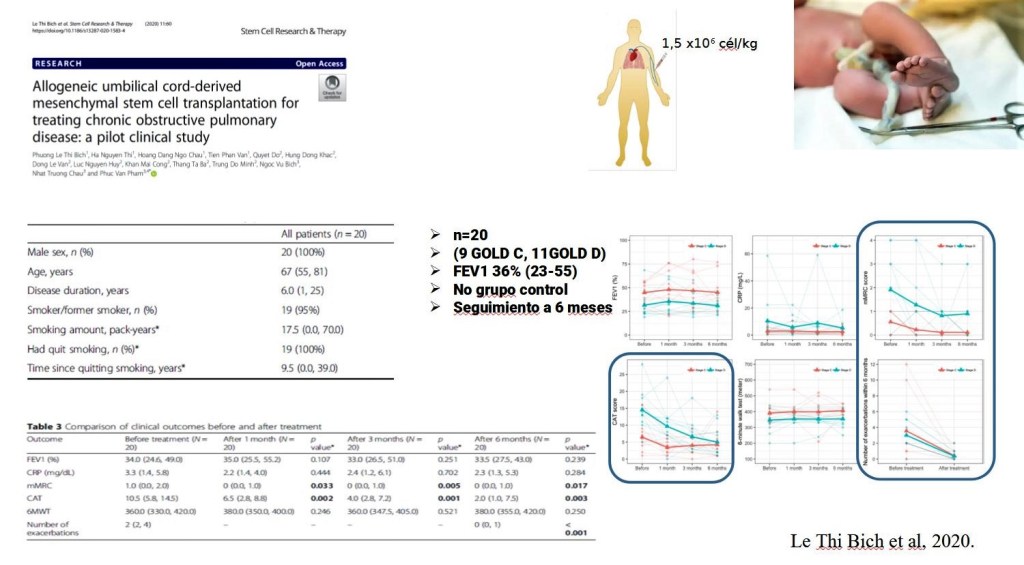Células mesenquimales y epoc