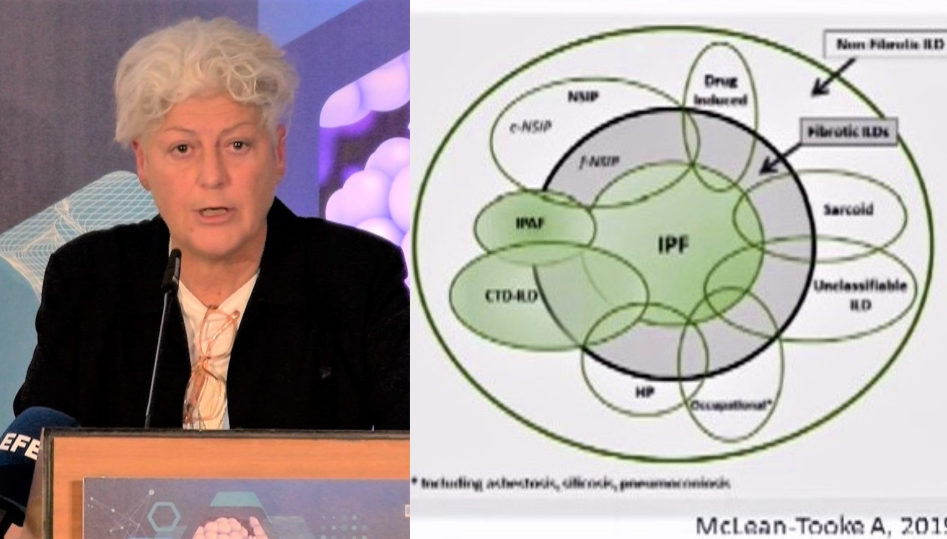 Reumatología y enfermedades intersticiales pulmonares: fibrosis
