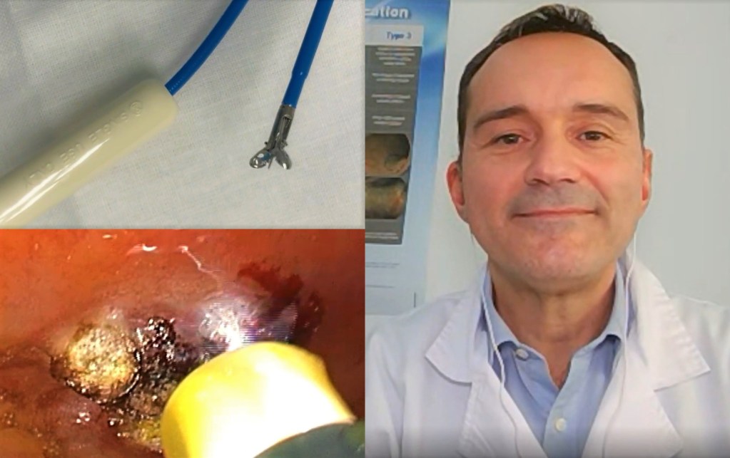 Herramientas endoscopia.