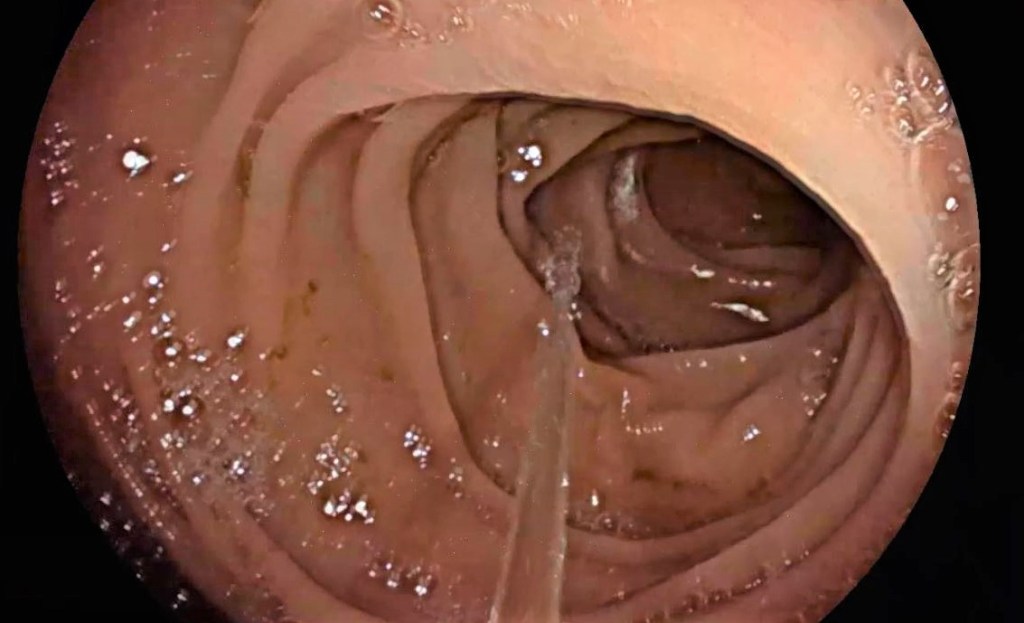 Mitos endoscopias digestivas