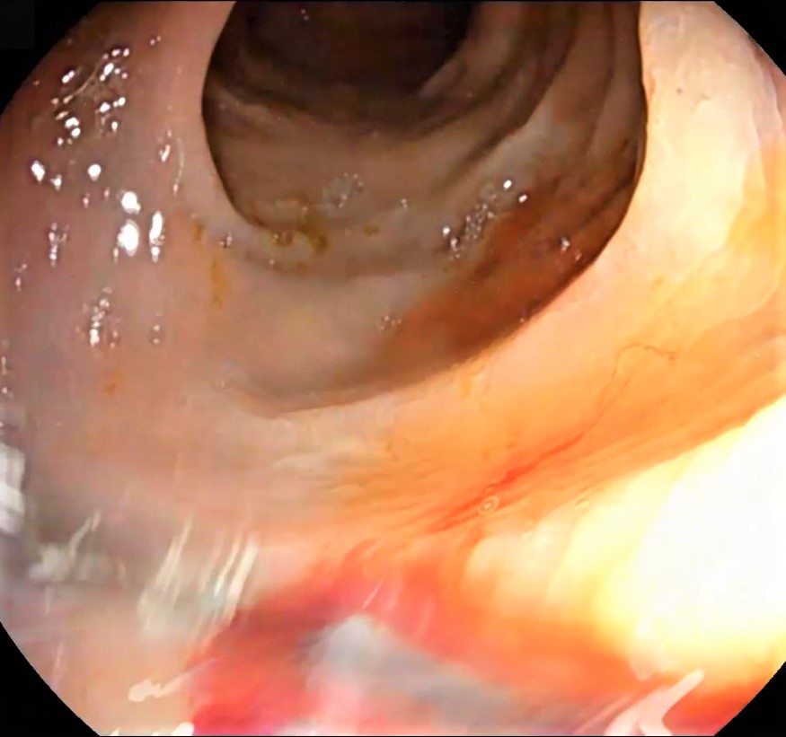 Mitos endoscopias digestivas