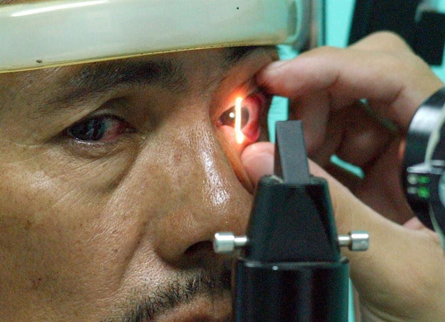 Glaucoma dudas