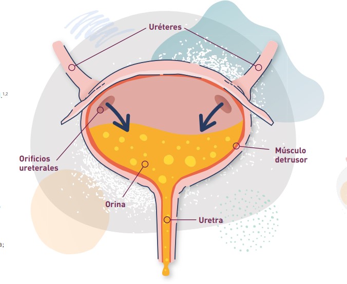 cáncer vejiga pacientes