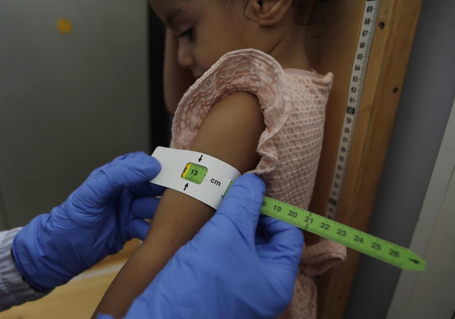 desnutrición infantil 