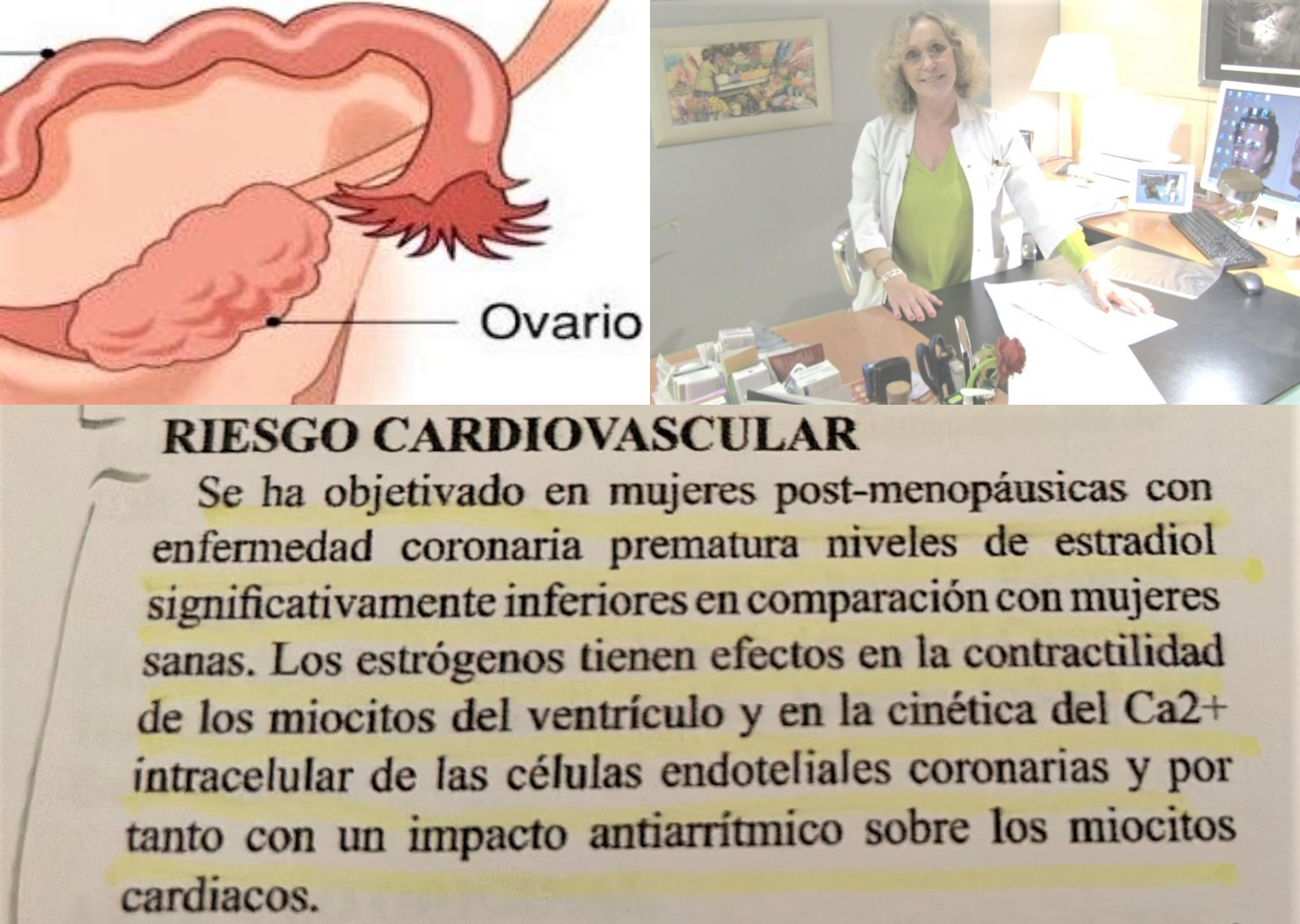 Riesgo cardiovascular producto del fallo ovárico prematuro.