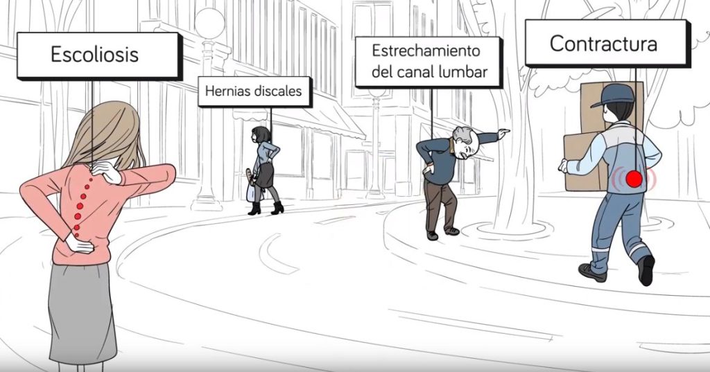 dolor lumbar