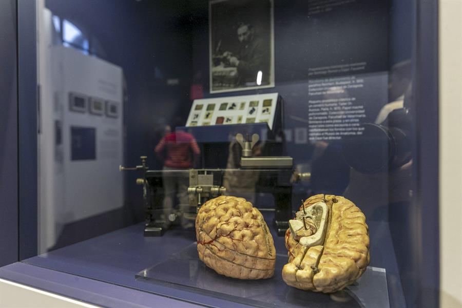 menores pantallas cerebro