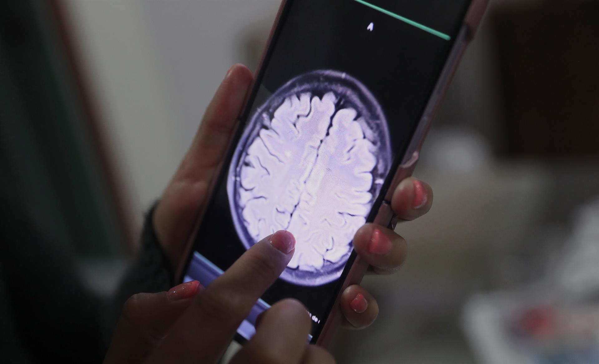 envejecimiento cerebral