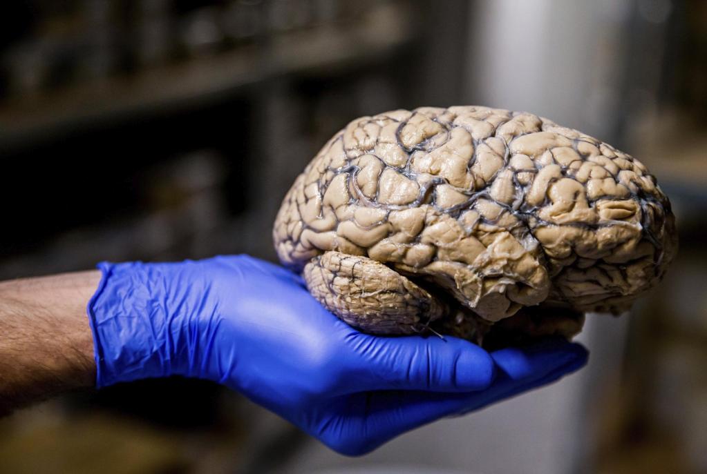 nuevas tecnologías cerebro
