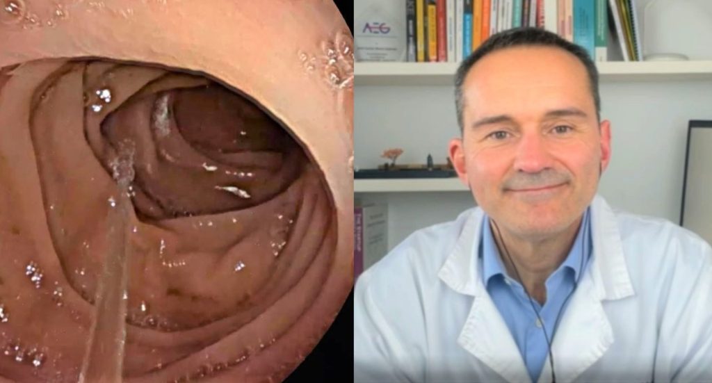 microbiota.