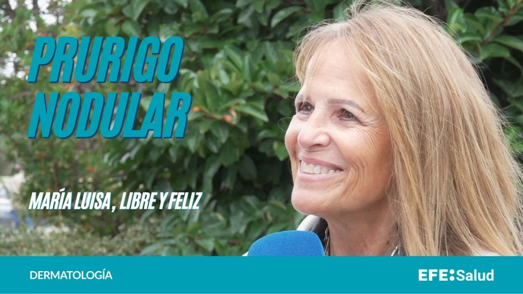 Prurigo nodular.