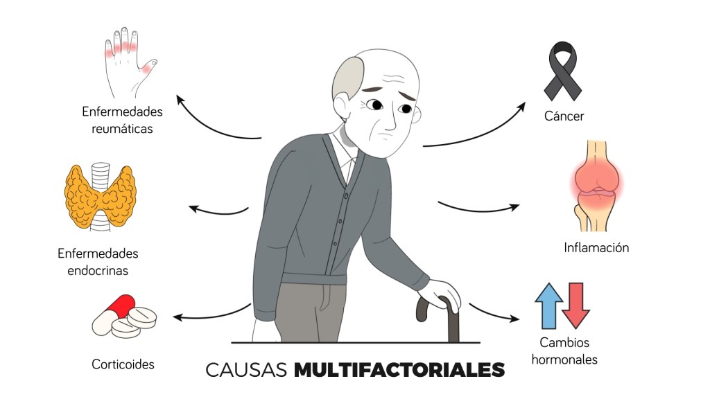 sarcopenia mayores