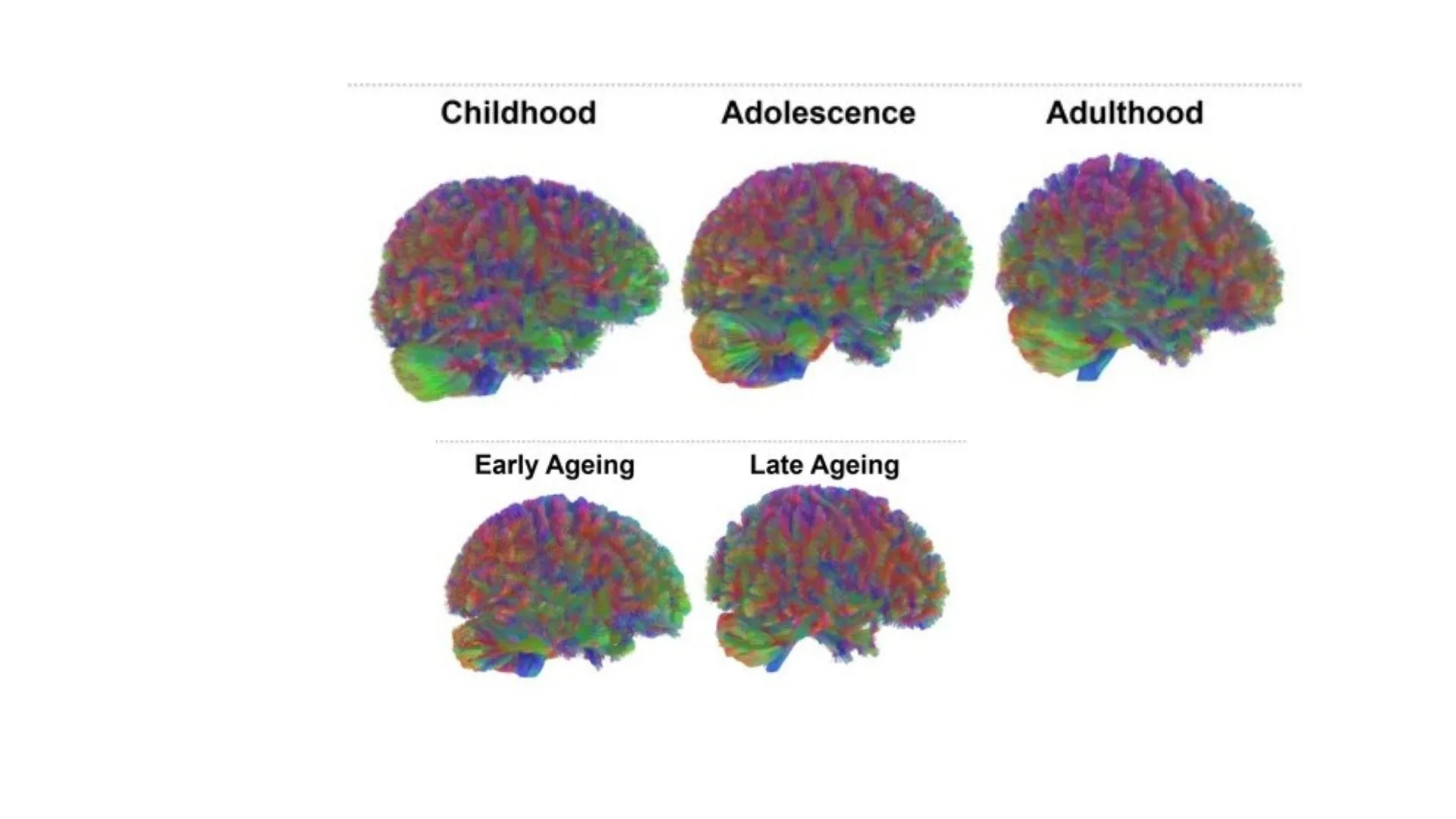 cerebro cambios